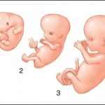 اسفنج اسپرم کش ضد بارداری