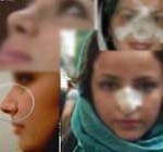 جراحی زیبایی دختران